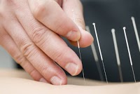 Fr acupuncture Brighton and Hove 727068 Image 0